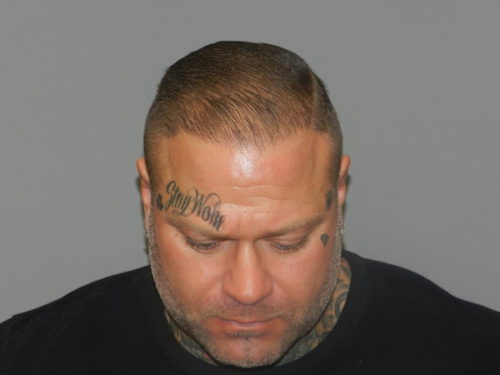 after neograft hair restoration male patient front view case 11904 Newport Beach, CA